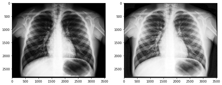 X-ray image for equalization